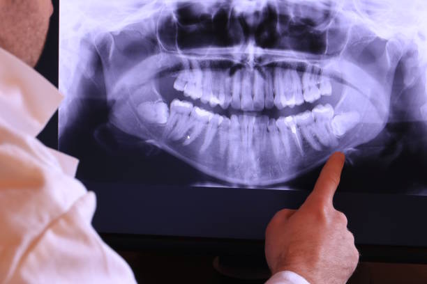 Best After-Hours Emergency Dentist in Brevard, NC