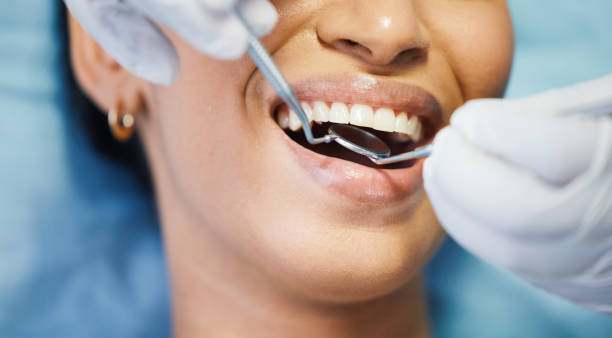 Best Emergency Treatment for Toothache in Brevard, NC