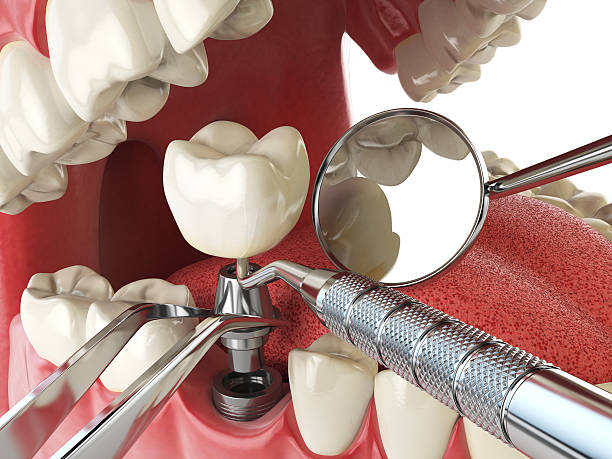 Best Pediatric Emergency Dentist in Brevard, NC